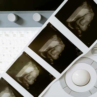 Instagram post from Ultrasound Trainers studio